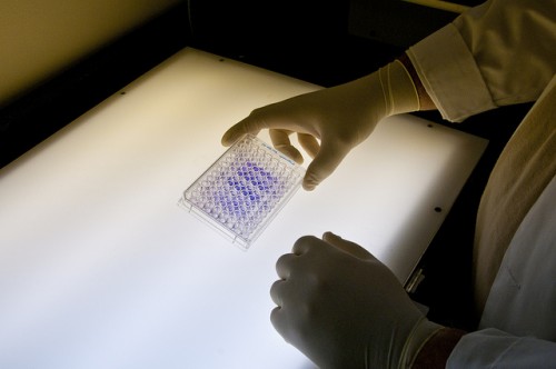 Auspex Pharmaceuticals, Inc. (ASPX)