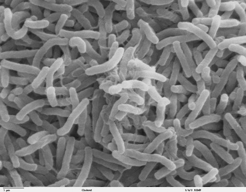 800px-Cholera_bacteria_SEM
