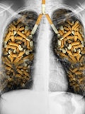10 Countries With the Highest Rates of Lung Cancer in the World