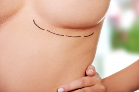 Most Popular Plastic Surgery Procedures - Breast lift