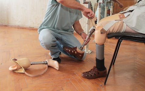 leg, limb, care, substitute, rehabilitate, amputee, artificial, medical, weight, amputation, adversity, accident, distribution, disability, balance, prosthesis, walk, rehabilitation,