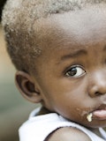 25 Countries with the Highest Death Rate From Malnutrition
