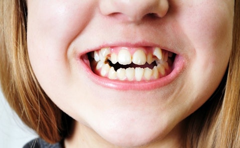25 Best States For Orthodontists