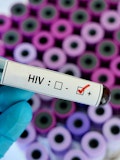 10 Countries With The Highest HIV Rates in Europe