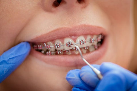 25 Best States For Orthodontists