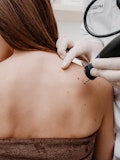 20 Countries with the Highest Rates of Skin Cancer