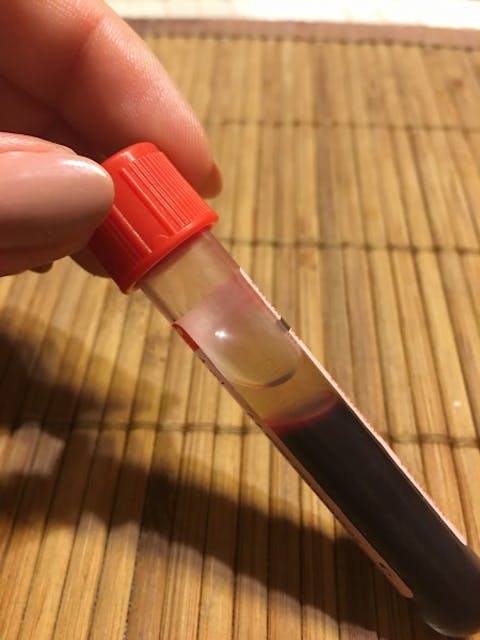 25 Cities With The Highest STD Rates in America