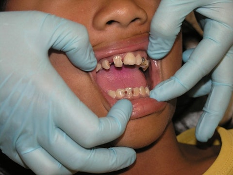 Top 10 Countries With the Worst Teeth, Oral Health and Hygiene in the World