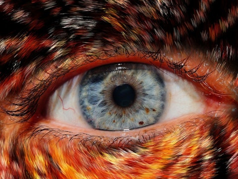 10 Uncommon Genetic Mutations in Humans