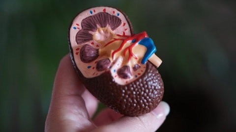 dialysis. kidney